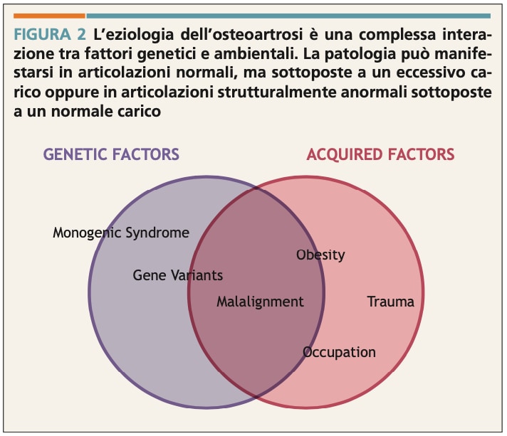 osteoartrosi