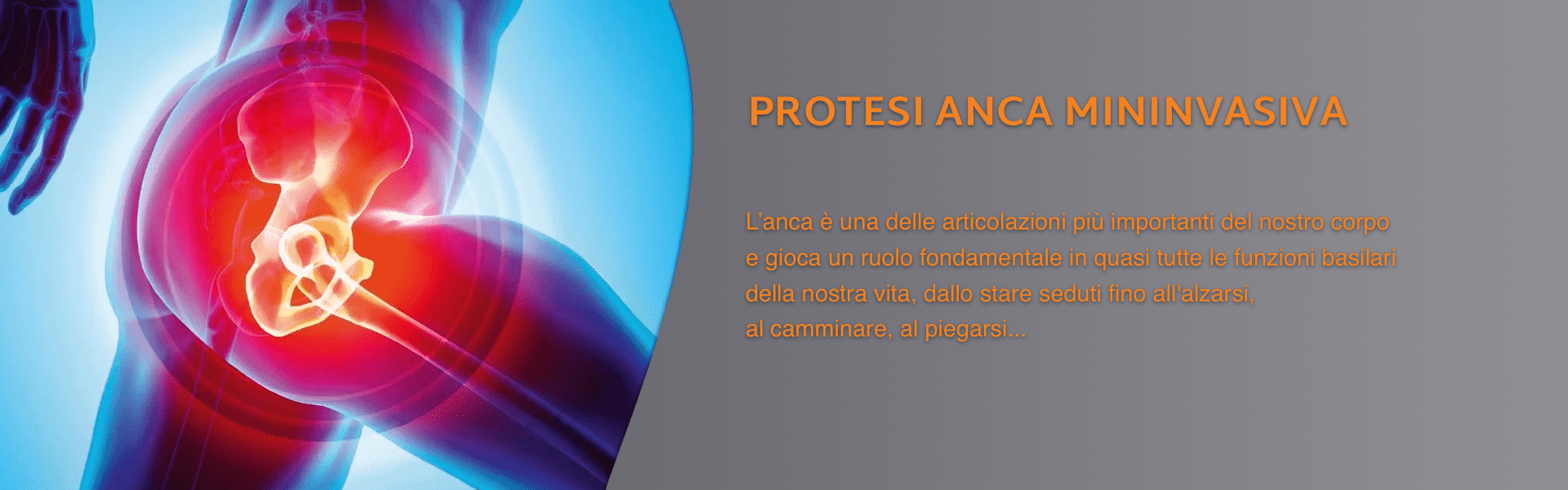 protesi anca mininvasiva